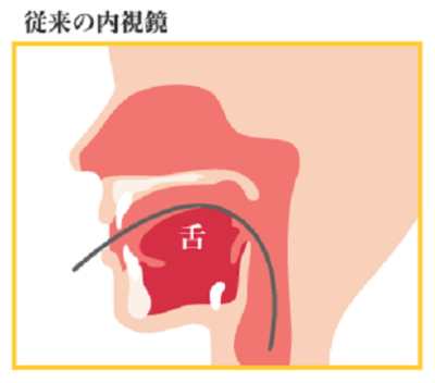 従来の内視鏡