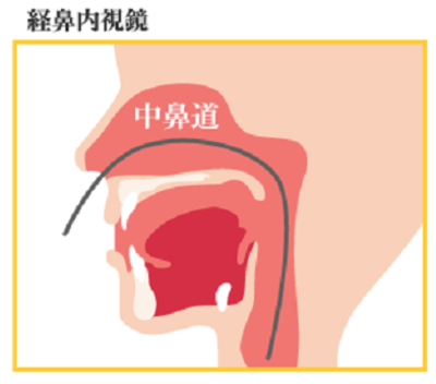 経鼻内視鏡